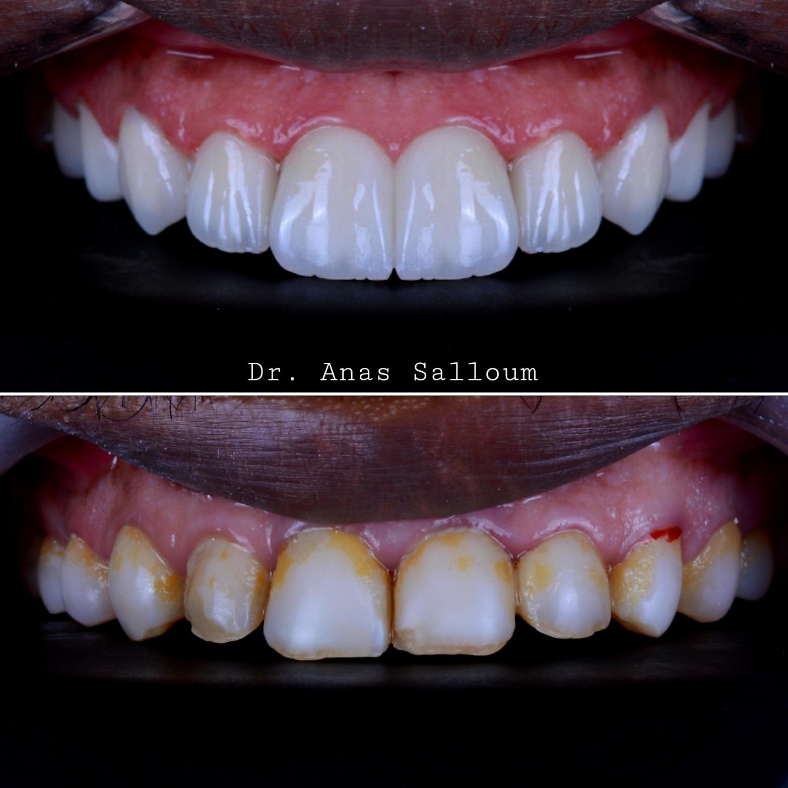 Before & After