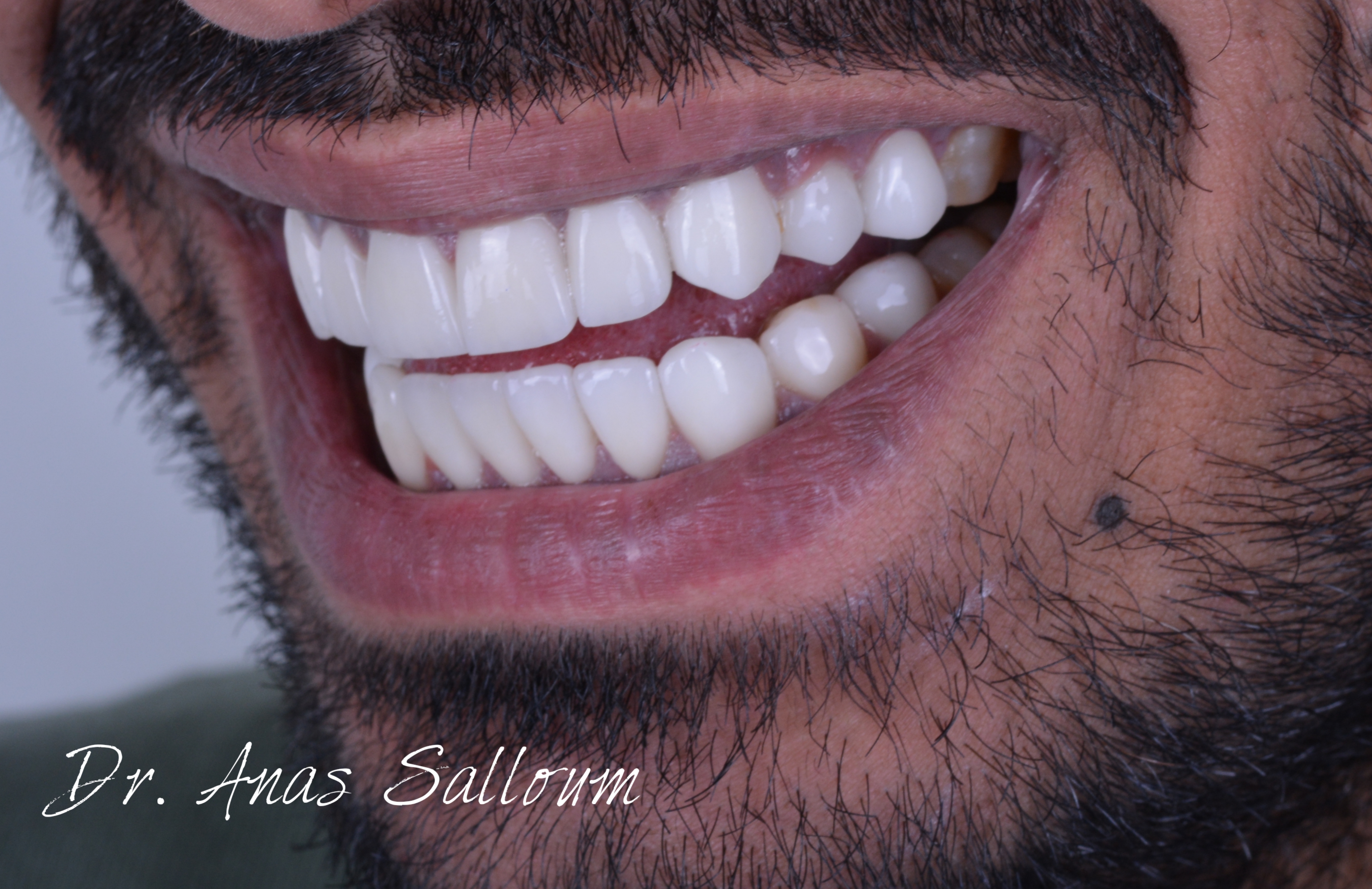 Dental Work